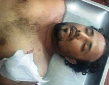 تعز..الرصاص الحي بديلا لاشارات المرور.. والنتيجة مقتل سائق حافلة!!