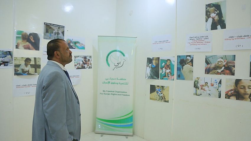 تنظيم معرضاً مصوراً لجرائم مليشيا الحوثي الانسانية بحق نساء واطفال بتهامة