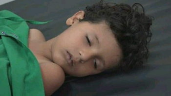 الحديدة . خمسة اطفال يتعرضون لمجزرة حوثية في الدريهمي