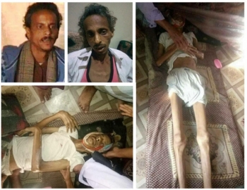 الكشف عن أبشع جرائم ارتكبها الحوثي بحق الشعب اليمني