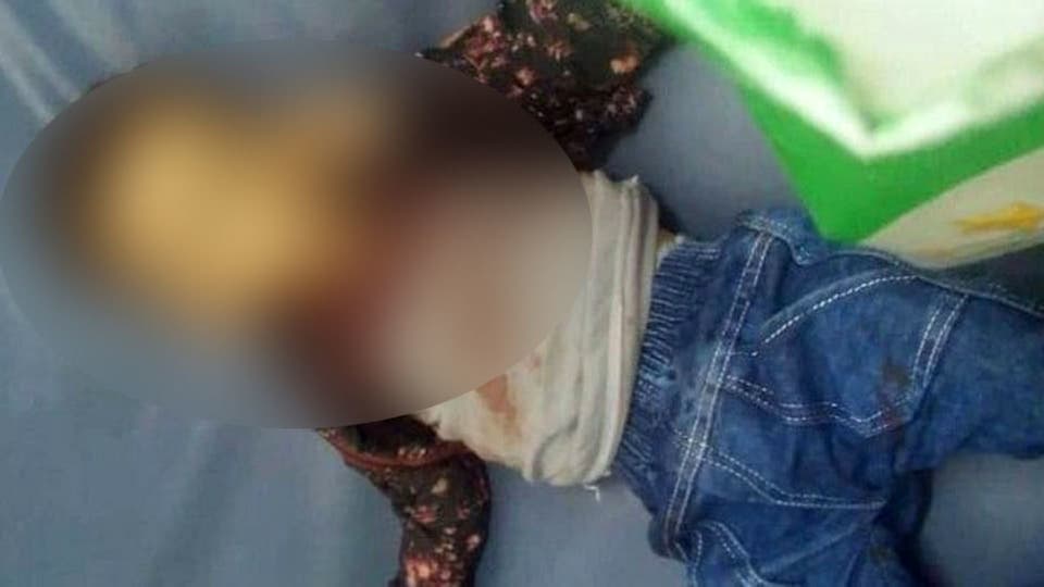 الثالث خلال 24 ساعة.. رصاص الحوثي يخطف ابن الـ3 أعوام (صور مؤلمة)