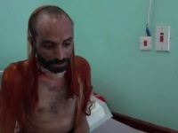 بالفيديو وكالة أمريكية تفضح وسائل التعذيب بالسجون الحوثية