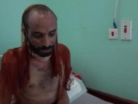 "دعه يموت".. معتقلون سابقون لدى الحوثيين يكشفون تفاصيل تعذيب وحشي