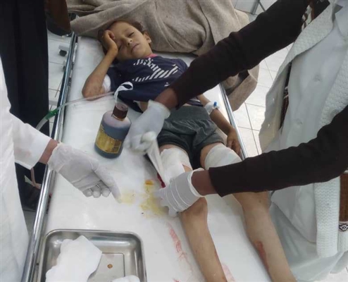 ارتفاع ضحايا قصف مخيم الحمة بمأرب إلى 6 أطفال وامرأة