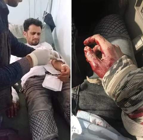 نقابة الصحفيين تدين مقتل المصور "لبحش" واستهداف الصحفي الشعيبي بقعطبة