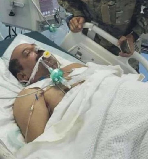صورة مؤثرة للواء الشهيد أدمت قلوب اليمنيين واثارت قريحة الشعراء وأشعلت مواقع التواصل