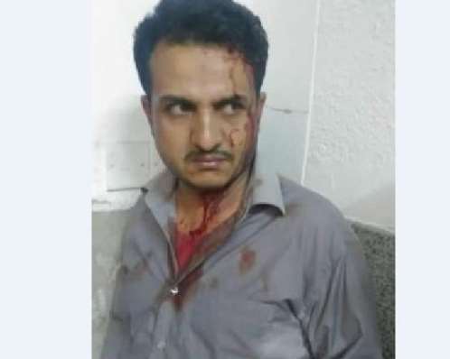 شاهد بالصورة .. قيادي حوثي يعتدي بالضرب على طبيب بصنعاء 