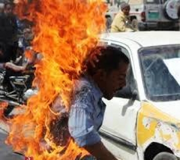 صنعاء ..مواطن من ريمة يصب النار على جسده امام دار المشاط ..والميلشيا تتوعد !!