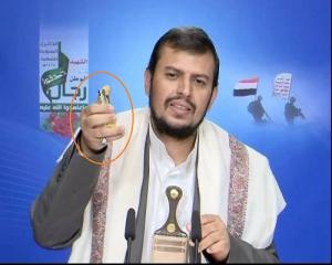 عجز الطاقة الاستيعابية لمستشفيات رئيسية تستقبل وتعالج جرحى المليشيا الحوثية بصنعاء .. العنصرية الهاشمية تعاقب مئات الجرحى في حروبها العبثية 