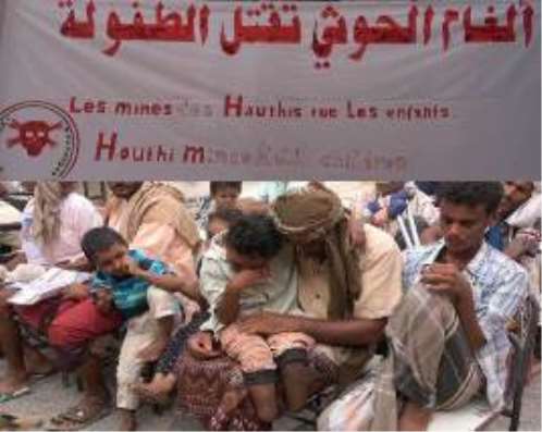 ألغام الحوثي تحصد 2500 مدني في الساحل الغربي