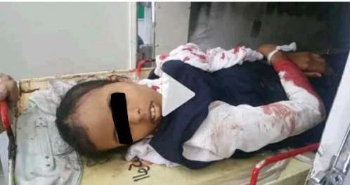 مقتل وإصابة 5 طالبات بقصف حوثي على مدينة تعز