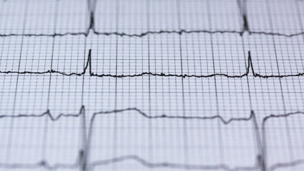خمس طرق تحميك من خطر الإصابة بنوبة قلبية قاتلة