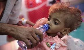 الصحة العالمية : "الخناق" (الدفتيريا) تقتل 257 في اليمن